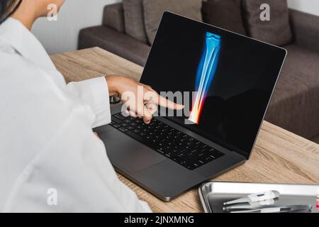 Nahaufnahme eines Arztes mit einer Röntgenaufnahme des Knöchels. Schmerzen Knöchelverletzung Stockfoto