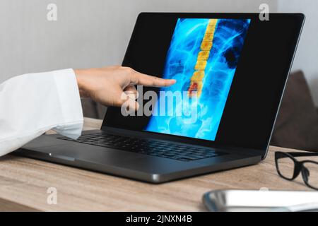 Arzt, der eine Röntgenaufnahme von Schmerzen in der Wirbelsäule zeigt. Trauma bei Rückenschmerzen Stockfoto