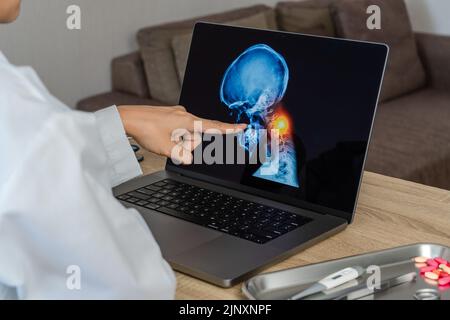 Arzt, der eine Röntgenaufnahme von Schmerzen im Nacken zeigt. Migräne und Rückenschmerzen. Stockfoto