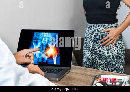 Arzt zeigt eine Röntgenaufnahme der Schmerzen in den Hüften auf einem Laptop. Patientin im Hintergrund Stockfoto