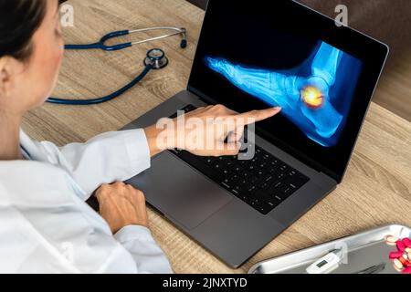 Nahaufnahme eines Arztes, der eine Fußröntgenaufnahme zeigt. Schmerzen Knöchel- und Fußverletzungen Stockfoto