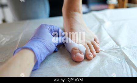 Arzt Orthopäde Anwendung Korsett für Hallux Valgus für Patienten. Stockfoto