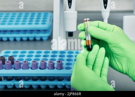 Labortechniker in Schutzhandschuhen, die mit Blutteströhrchen arbeiten Stockfoto