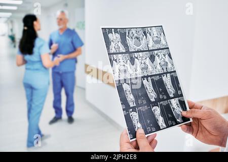 CT-Scan des Abdomens des Patienten in den Händen des Arztes, Nahaufnahme, über dem Hintergrundkorridor medizinische Klinik und medizinisches Personal während des Arbeitstages Stockfoto