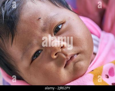 Eine Mücke auf der Stirn eines kleinen Mädchens. Stockfoto