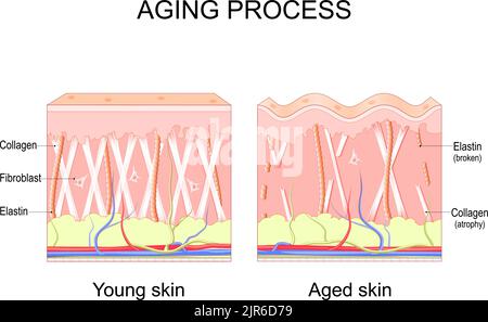 Alterungsprozess. Vergleich von junger und gealterter Haut. Kollagen, Elastin und Fibroblasten bei jüngerer und älterer Haut. Altersbedingte Veränderungen in der Haut Stock Vektor