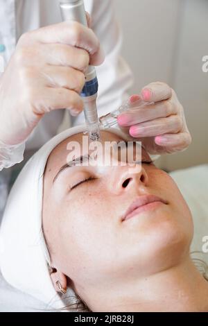 Mikronadeln für die Kollagen-Induktionstherapie. Microneedle RF-Heben. Verfahren für Schönheit und Verjüngung. Junge Frau in einem Schönheitssalon Stockfoto