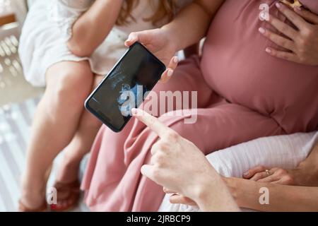 Hand einer Schwangeren, die den Freunden Ultraschallergebnisse auf dem Smartphone zeigt Stockfoto