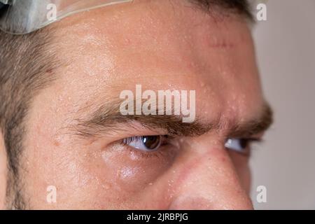 Selektiver Fokus, Nahaufnahme eines verschwitzten, erschöpften Männergesichts mit Markierungen der Sicherheitsausrüstung. Stockfoto