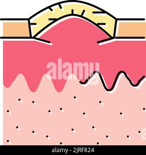 Boxcar Akne Narbe Farbe Symbol Vektor Illustration Stock Vektor