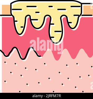 Hyperpigmentierung Akne Narbe Farbe Symbol Vektor Illustration Stock Vektor