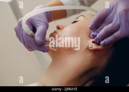 Frau Bekommen Vakuum Reinigung Gesichtsbehandlung In Beauty Clinic Stockfoto