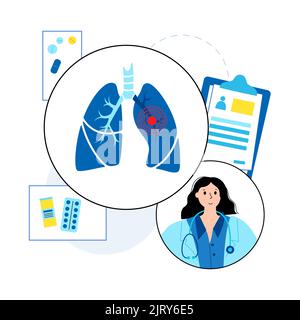 Behandlung der Lungenembolie, Illustration Stockfoto