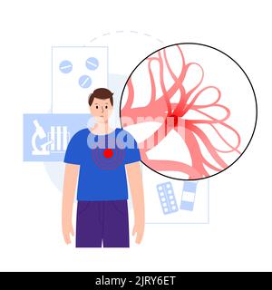 Behandlung der Lungenembolie, Illustration Stockfoto