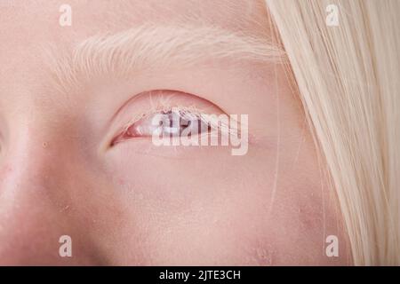 Nahaufnahme eines jungen Albino-Mädchens mit blauen Augen und weißen Wimpern Stockfoto