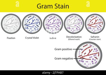 Diagramm mit gramfärbendem Mikrobiologie Laborverfahren Schritte - Mikrobiologie Labor mit Kristallviolett und Safranin Stock Vektor