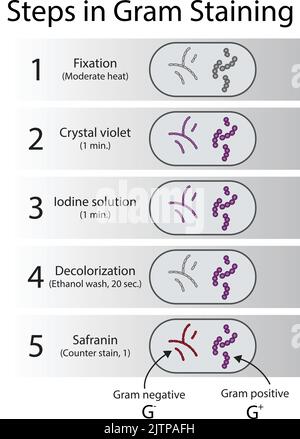 Diagramm mit gramfärbendem Mikrobiologie Laborverfahren Schritte - Mikrobiologie Labor mit Kristallviolett und Safranin Stock Vektor