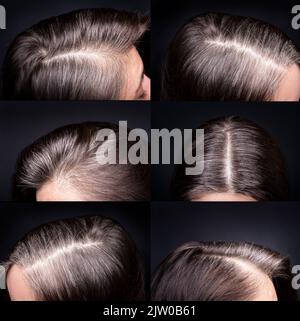 Frauenkopf mit grauen Haaren, Nahaufnahme von nachwuchenden Wurzeln, Draufsicht auf dunklem Hintergrund Stockfoto