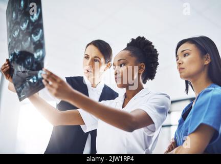 Eine zweite Meinung. Eine Gruppe von medizinischen Fachleuten untersucht eine Röntgenaufnahme im Krankenhaus. Stockfoto