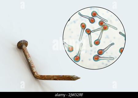 Übertragung von Tetanusbakterien. Konzeptionelle Illustration mit einem alten rostigen Metallnagel als Infektionsquelle und einer Nahaufnahme von Clostridium tetani-Bakterien, der Ursache von Tetanus. Stockfoto