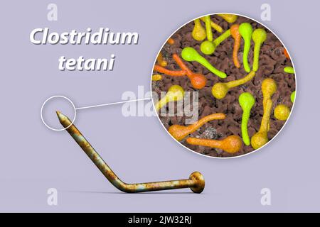 Übertragung von Tetanusbakterien. Konzeptionelle Illustration mit einem alten rostigen Metallnagel als Infektionsquelle und einer Nahaufnahme von Clostridium tetani-Bakterien, der Ursache von Tetanus. Stockfoto