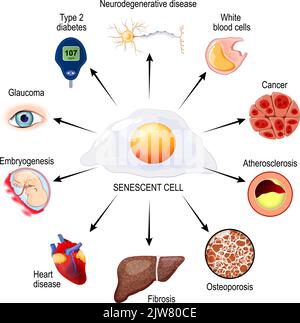 Zelluläre Seneszenz und Gesundheitsrisiken. Rollen, die seneszente Zellen im menschlichen Körper spielen. Biologische Uhr, Alterungsprobleme, Krebs, Verletzungen und Krankheiten. Stock Vektor