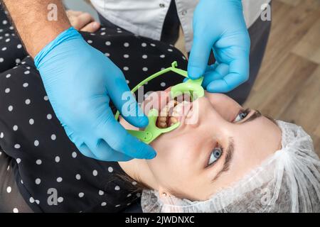 Zahnarzt Installation auf einem Patienten Wangenaufroller in Zahnarztpraxis Stockfoto