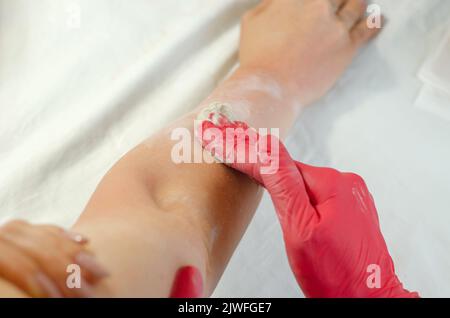Zucker Enthaarung der weiblichen Hände, Nahaufnahme. Verfahren zur Entfernung von Handhaaren Stockfoto