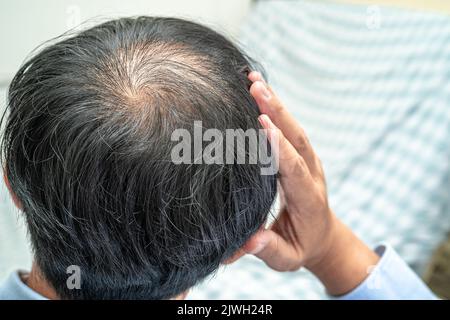 Glatze in der Mitte Kopf und beginnen keinen Verlust Haar glabrous der reifen asiatischen Geschäft smart aktiven Büromann. Stockfoto