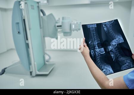 Der Radiologe betrachtet und analysiert die Röntgenaufnahme der Halswirbelsäule des Patienten vor dem Hintergrund eines modernen Radiologieraums im Krankenhaus Stockfoto