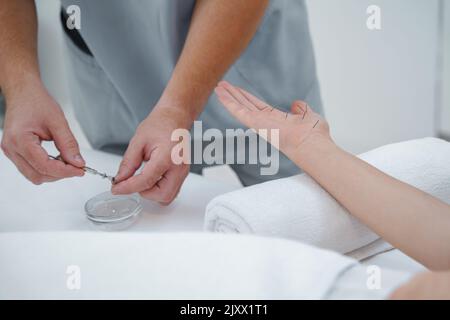 Arzthand Führen Sie eine professionelle Akupunkturbehandlung im Beauty Spa am Körper der Frau durch Stockfoto