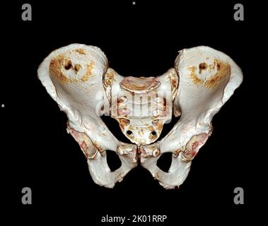 CT-Scan von Becken- und Hüftgelenk 3D zur Diagnose Fraktur von Becken- und Hüftgelenk isoliert auf weißem Hintergrund. Stockfoto