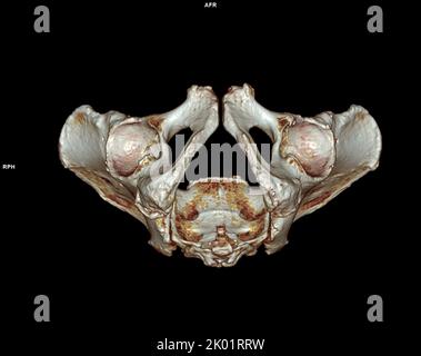 CT-Scan von Becken- und Hüftgelenk 3D zur Diagnose Fraktur von Becken- und Hüftgelenk isoliert auf weißem Hintergrund. Stockfoto