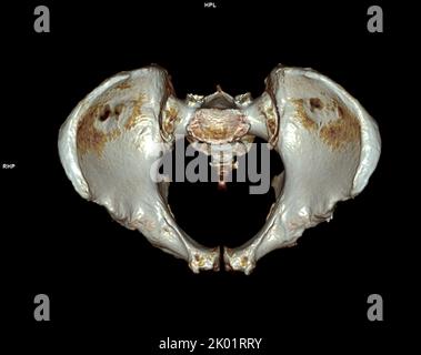 CT-Scan von Becken- und Hüftgelenk 3D zur Diagnose Fraktur von Becken- und Hüftgelenk isoliert auf weißem Hintergrund. Stockfoto