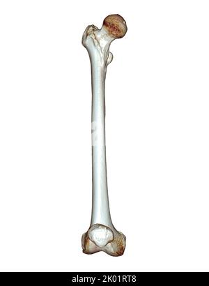 CT-Scan des Femurknochens und Oberschenkelknochens 3D zur Diagnose Fraktur des Femurknochens isoliert auf weißem Hintergrund. Beschneidungspfad. Stockfoto