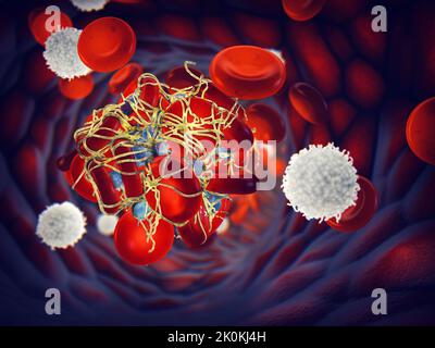 Aktivierte Blutplättchen (Thrombozyten) bilden ein Blutgerinnsel (Thrombus), das mit Fibrin-Mesh bedeckt ist. Die Blutplättchen sind Blutzellen, die den Blutgefäßschaden reparieren Stockfoto