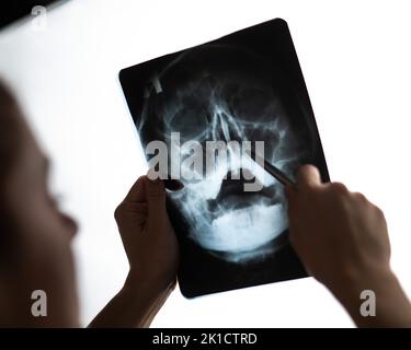 Der Arzt betrachtet die Röntgenaufnahme der Nebenhöhlen. Stockfoto