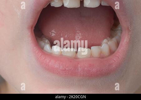 Kiefer mit geraden Zähnen des Kindes Nahaufnahme, Milch und dauerhafte Zähne bei einem Kind. Stockfoto