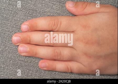 Schmutzige und schlampig getrimmte Fingernägel, Finger und Zehennägel des Kindes in Nahaufnahme, Finger des kleinen Kindes auf grauem Hintergrund. Stockfoto