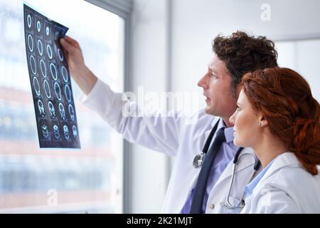 Die Diagnose sieht gut aus. Zwei Ärzte betrachten einen Hirnscan. Stockfoto