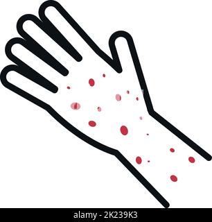 Roter Hautausschlag an der menschlichen Hand. Symbol für Krankheitssymptome Stock Vektor