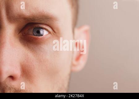 Junger besorgter Mann mit hartem Blick. Nahaufnahme Porträt Halbgesicht Stockfoto