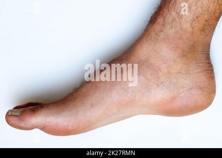 Zehen, Hände und Nägel. Männliche menschliche Körperteile im Alter von 20 bis 30 Jahren Stockfoto