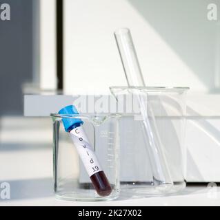 Blutentnahmeröhrchen von Covid-19-Patienten auf einem weißen Labortisch. Stockfoto