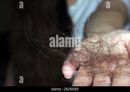 Das Mädchen hält einen Haufen gefallener Haare in den Händen. Nahaufnahme der Hand. Haarausfall Problem. Stockfoto