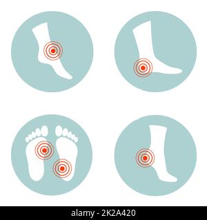 Flaches Design eines Gesundheitskonzeptes, Schmerzen und Verletzungen in Körperteilen. Frau fühlt Schmerzen in Fuß, Knöchel und Zehen. Stockfoto