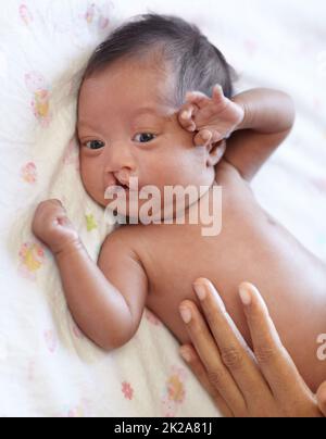 Die liebevolle Berührung einer Mutter. Eine junge Mutter, die ihre Hand mit einer Gaumenspalte auf ihr Baby legt. Stockfoto