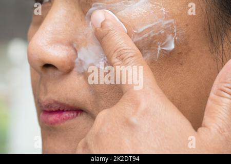 Asiatische Dame Frau Anwendung Creme Hautpflege Behandlung, um Flecken oder Melasma und dunkle Flecken in ihrem Gesicht zu lösen. Stockfoto