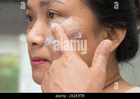 Asiatische Dame Frau Anwendung Creme Hautpflege Behandlung, um Flecken oder Melasma und dunkle Flecken in ihrem Gesicht zu lösen. Stockfoto