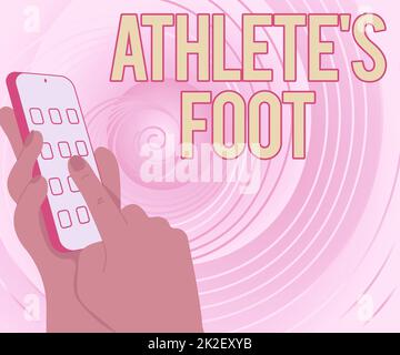 Konzeptunterschrift Athlete S ist Foot. Begriff der Bedeutung einer Pilzinfektion des Fusses, gekennzeichnet durch Blasen Hände halten technisches Gerät durch Drücken des Applikationstasters. Stockfoto